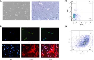 miR-654-5p Contributes to the Activation and Proliferation of Hepatic Stellate Cells by Targeting RXRα